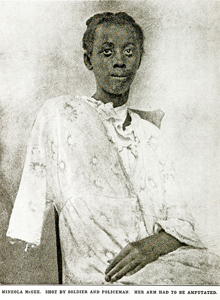 Mineola McGee, shot by soldier and policman. Her arm had to be amputated.